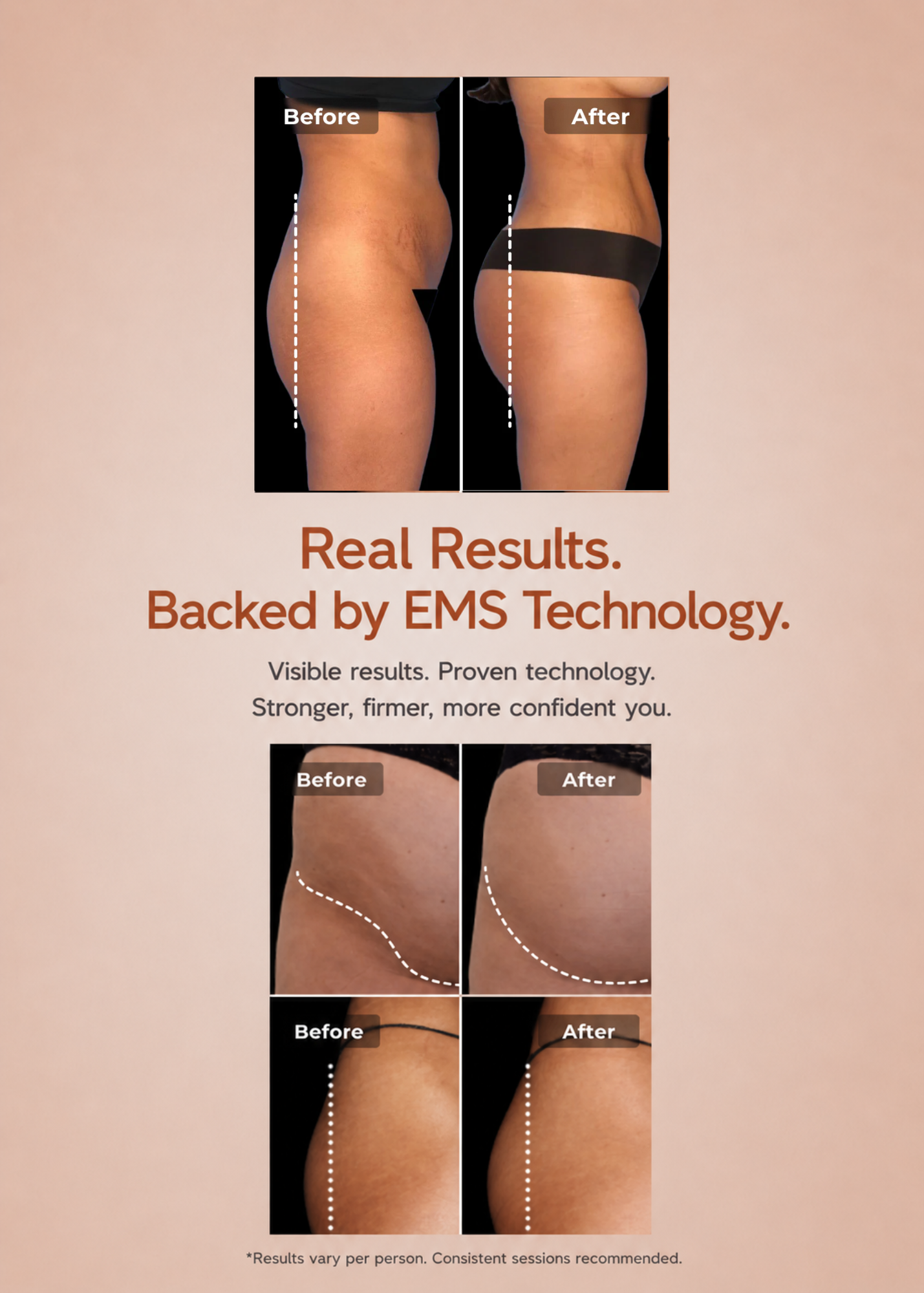 Sophia - EMSculpt™ Glute-Lift &amp; Tone Shorts